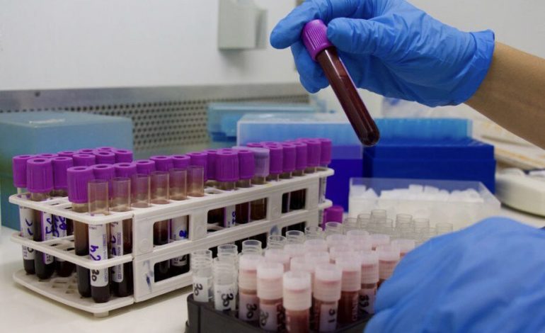 Exame de sangue que detecta Alzheimer chega ao Brasil, saiba mais