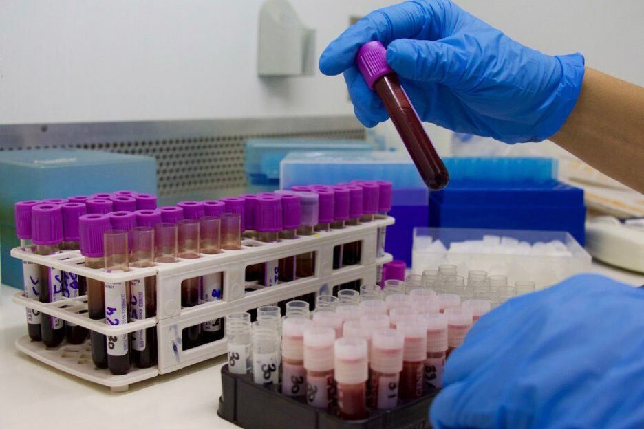 Exame de sangue que detecta Alzheimer chega ao Brasil, saiba mais